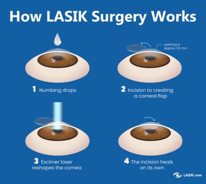 How can I get LASIK cheaper?