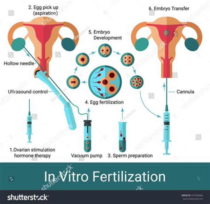 How much does a Artificial Insemination make?
