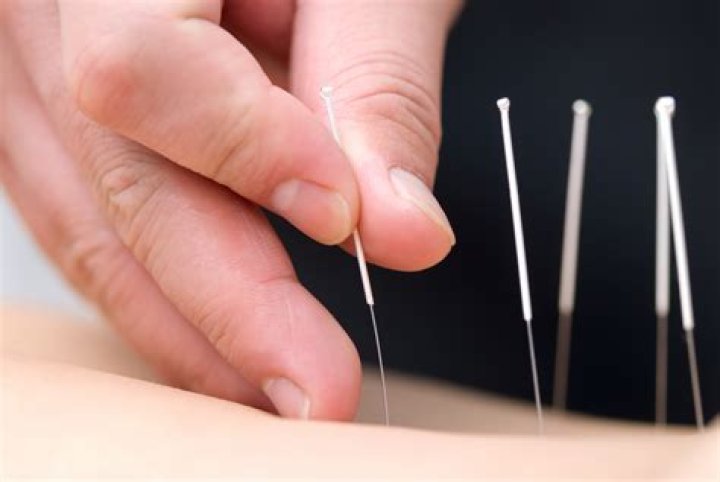 How much does an acupuncture earn?